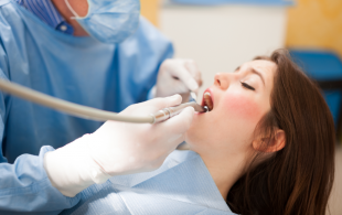 Les dentistes voudraient doubler leurs tarifs sur les soins courants