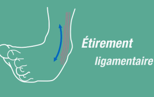 L’entorse de cheville