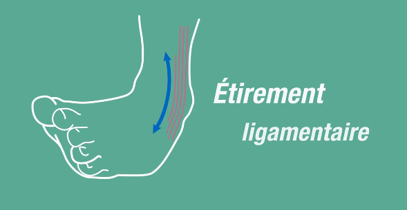L’entorse de cheville