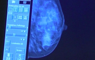 La mammographie 3D, vous connaissez ?