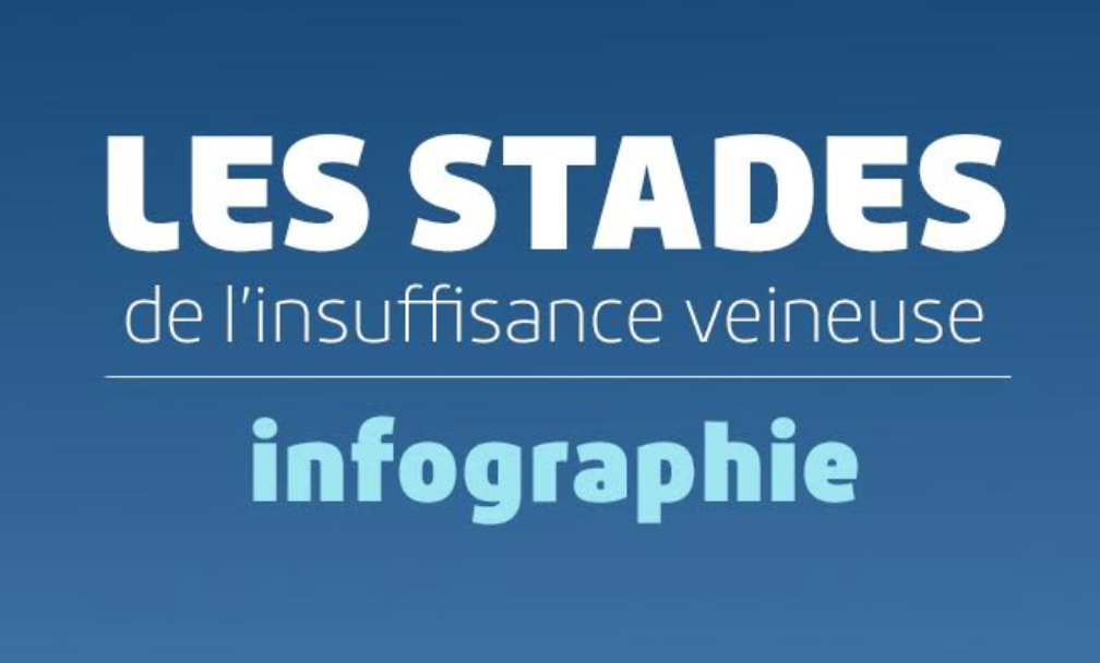 Les stades de l’insuffisance veineuse en un clic
