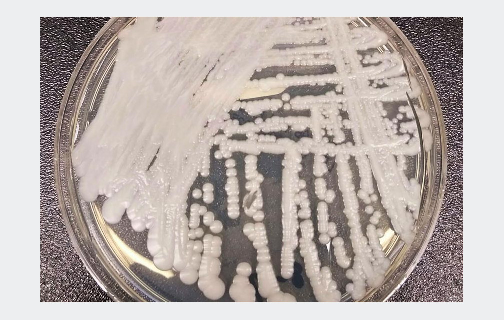 Le « Candida auris », ce champignon résistant aux traitements qui menace la santé mondiale