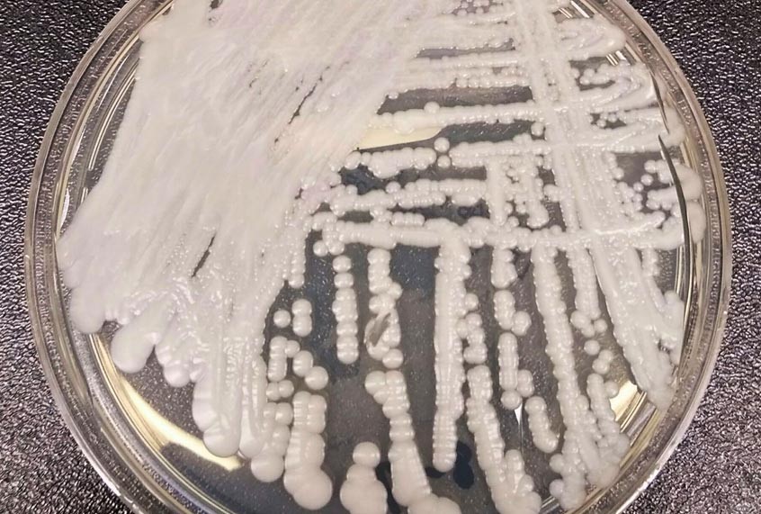 Le « Candida auris », ce champignon résistant aux traitements qui menace la santé mondiale