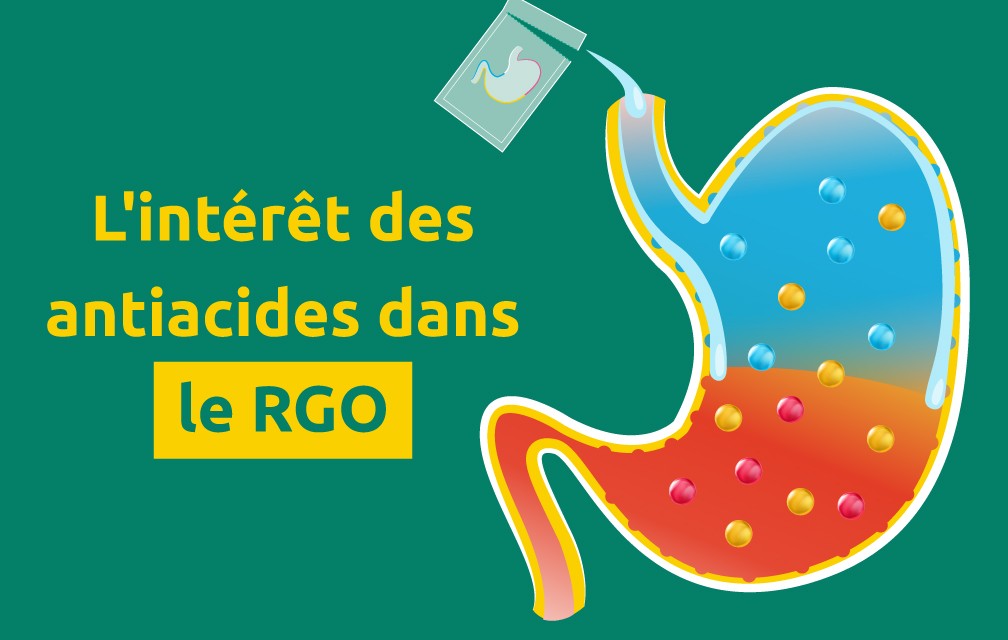 Quand conseiller un antiacide au comptoir ?