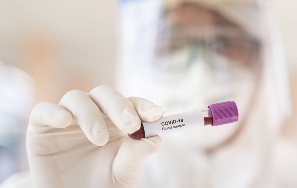 Covid-19 : tests sérologiques bientôt disponibles en pharmacie ?