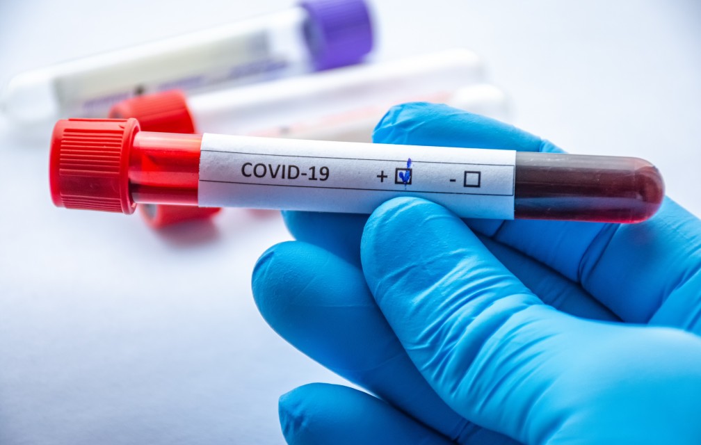 Les tests TROD Covid-19 disponibles en pharmacie